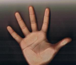 Phẫu thuật chỉ tay, thay đổi vận mệnh