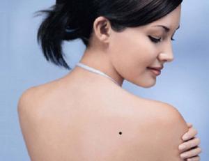 NỐT RUỒI SAU LƯNG: Có phải vì "gánh còng lưng" nên mới chịu vất vả?