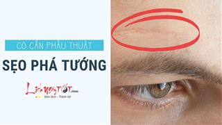 Sẹo phá tướng: Cơ thể hễ có là lo xui xẻo, có nên phẫu thuật thẩm mỹ?