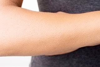 Hiện tượng nổi da gà là gì? Liệu có điềm báo gì đáng sợ không?