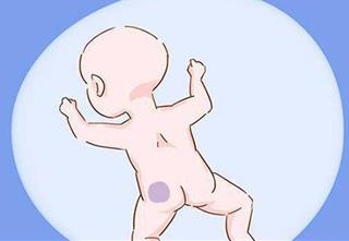 Vết bớt tiền kiếp: Có phải những vết bớt tiết lộ về kiếp trước của người đó?