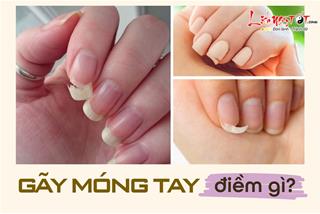 GÃY MÓNG TAY là điềm gì? Liệu có hiểm nguy nào đang rình rập bạn?