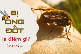 BỊ ONG ĐỐT là điềm gì? Bạn sắp đối diện với khó khăn hay tin vui dồn dập?