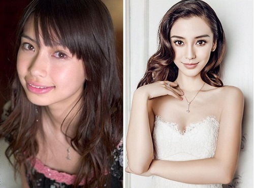 Angela Baby: Vận trình thay đổi nhờ phẫu thuật thẩm mỹ?