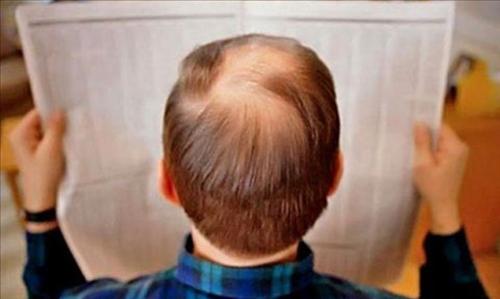 Xem tướng xoáy tóc tiết lộ điều không tưởng về con người bạn