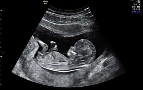 Vong thai nhi - nhiều điều chưa biết về phá thai ta đã để lại hậu quả khôn lường