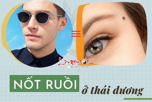 Giải mã bí mật về NỐT RUỒI Ở THÁI DƯƠNG đàn ông và phụ nữ: Tác động cát – hung ra sao tới chủ nhân?