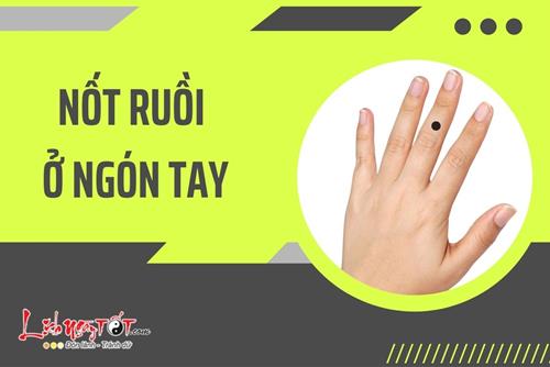 Giải mã tất tần tật về nốt ruồi trên ngón tay