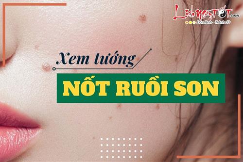 NỐT RUỒI SON thực sự có đem lại vận đỏ và may mắn cho chủ nhân?