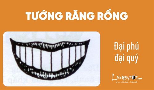 Xác định nhân cách qua tướng răng: Ai xấu ai tốt, mở miệng là thấy ngay, khó mà giấu được!