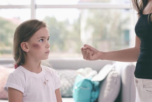 Dạy con bằng đòn roi - Tại sao không hiệu quả, nhiều hệ lụy mà ai cũng sử dụng?