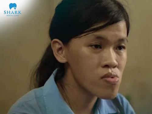 Mặt lưỡi cày có ý nghĩa gì? Giải pháp cải thiện hiệu quả nhất hiện nay